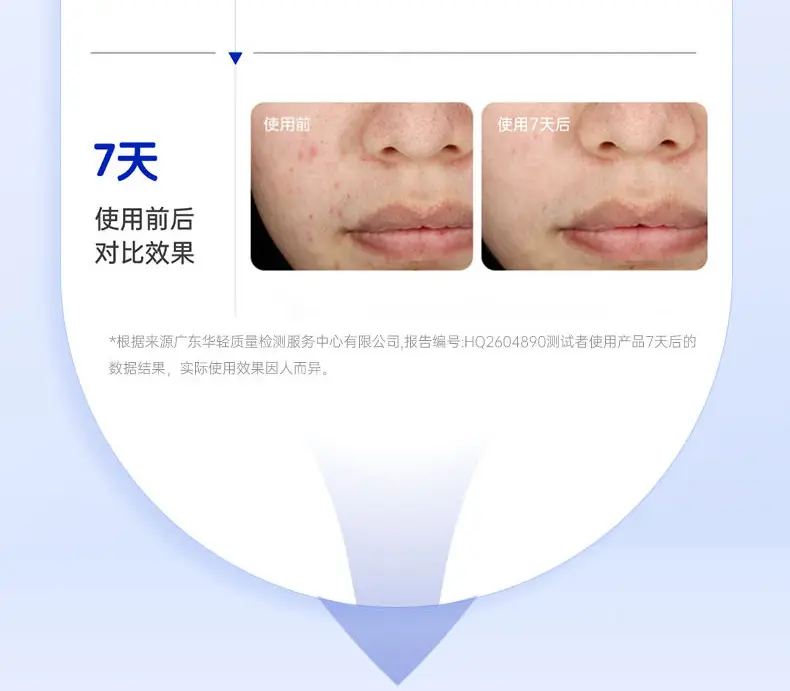 JunXian Blue Bottle Acne Serum II