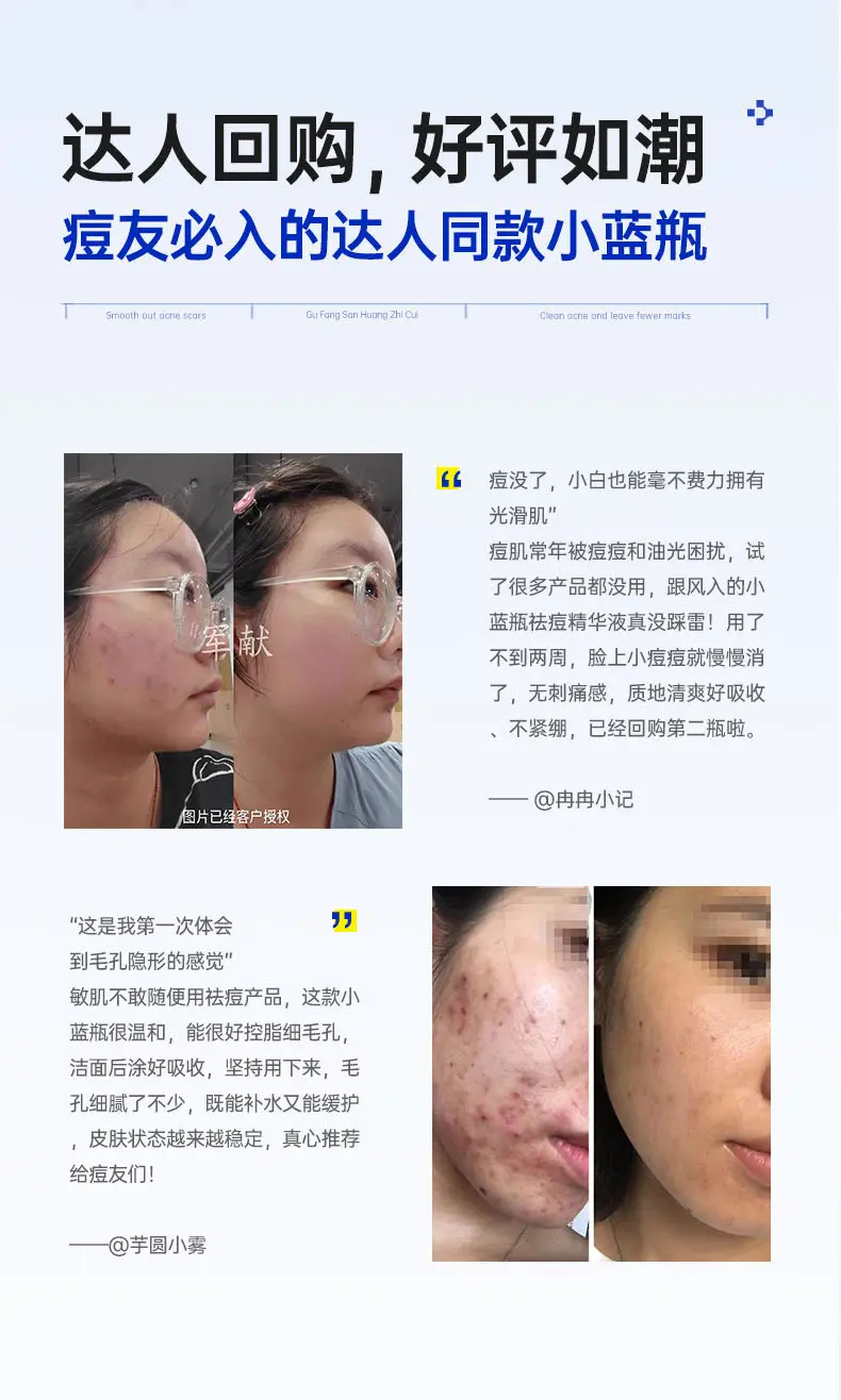 JunXian Blue Bottle Acne Serum II
