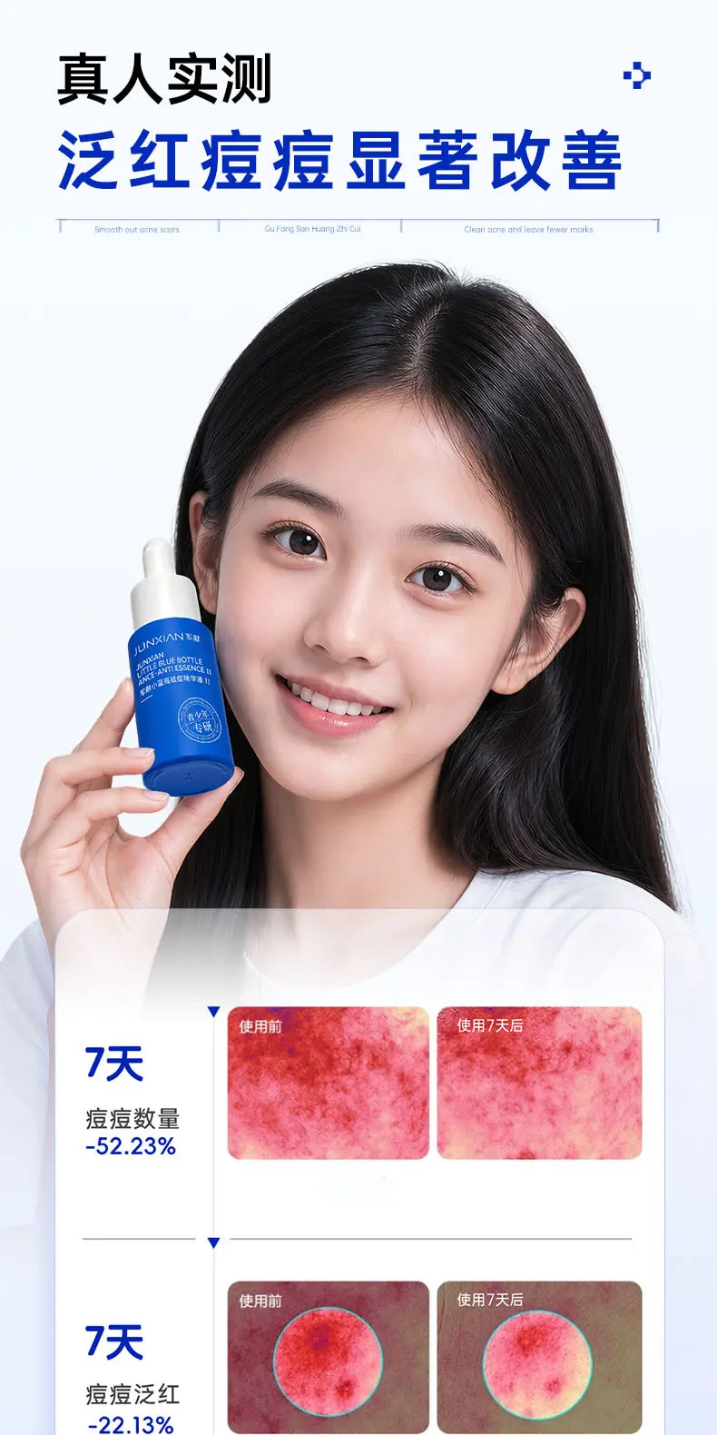 JunXian Blue Bottle Acne Serum II