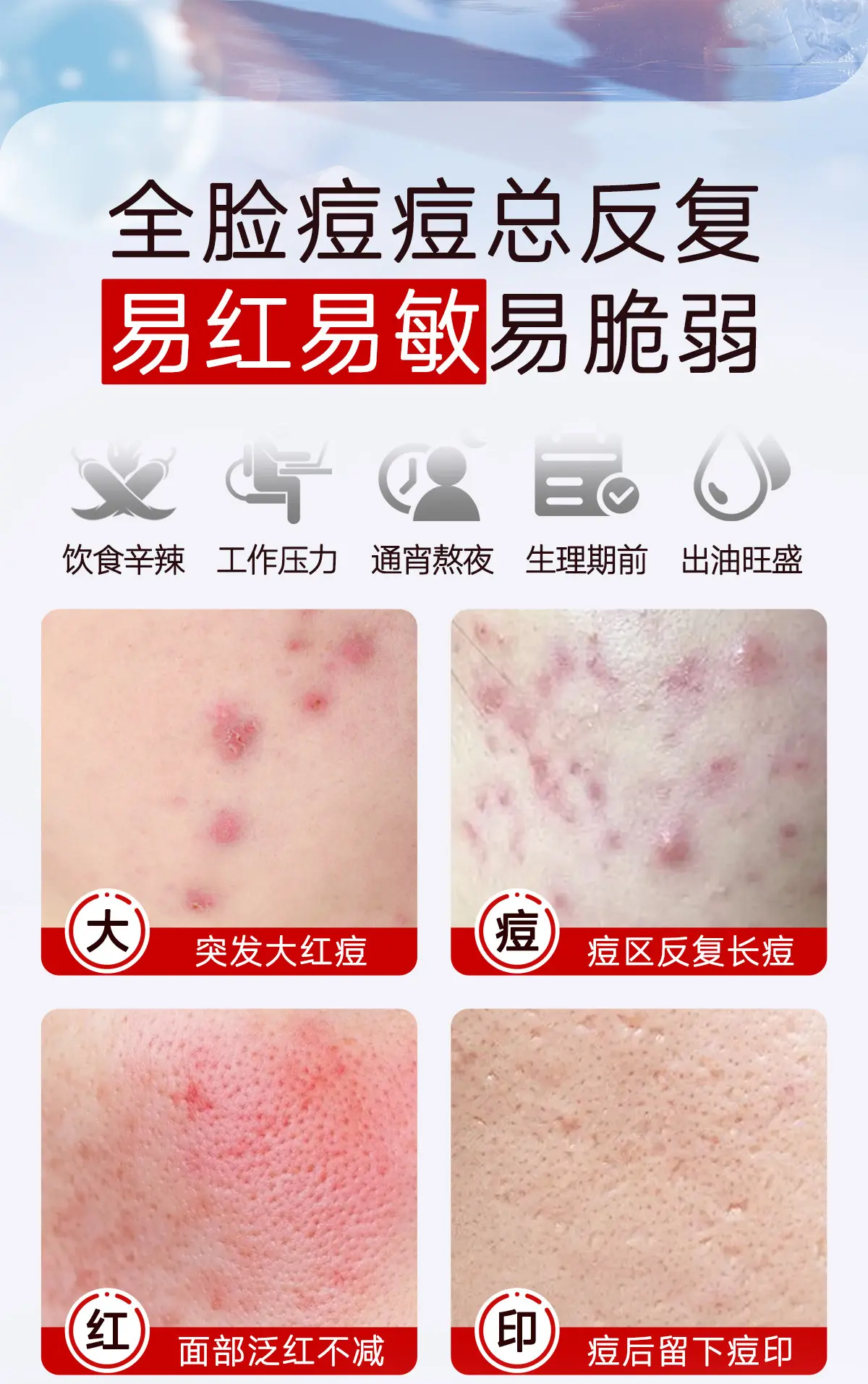 JunXian Clear Acne Mask