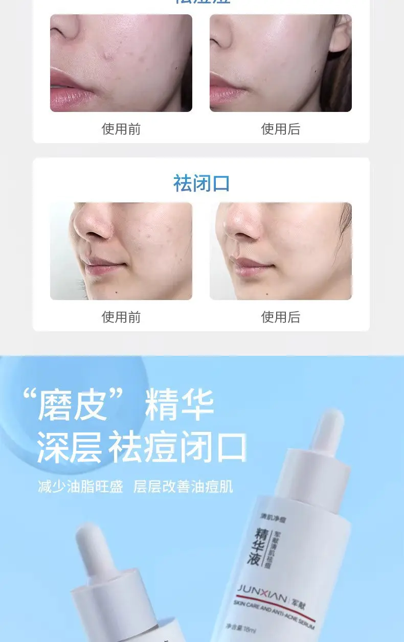 JunXian Clear Series Acne Essence