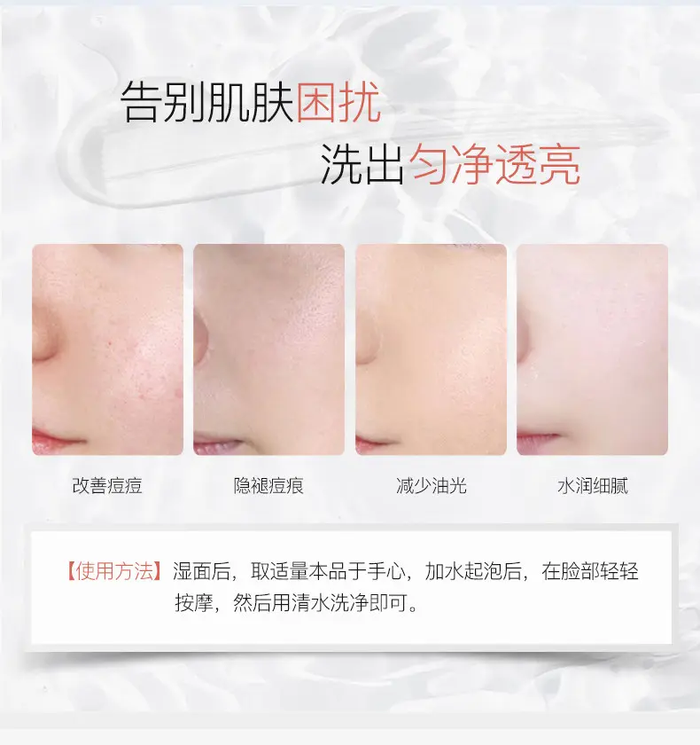 JunXian Acne Facial Wash