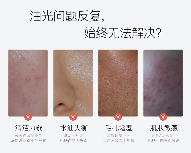 JunXian Acne Wash & Cream Combo Set