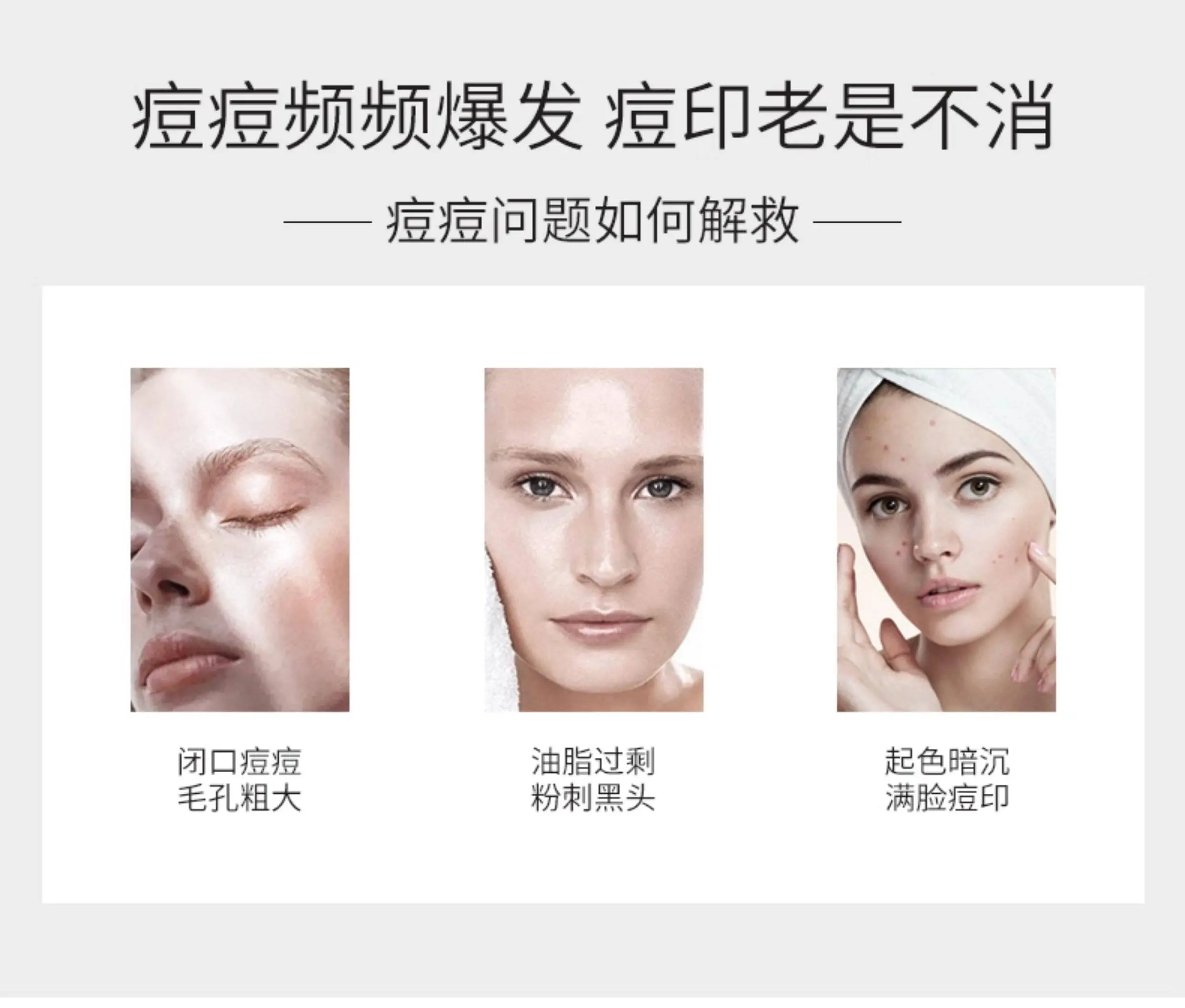 JunXian Acne Relief Cream