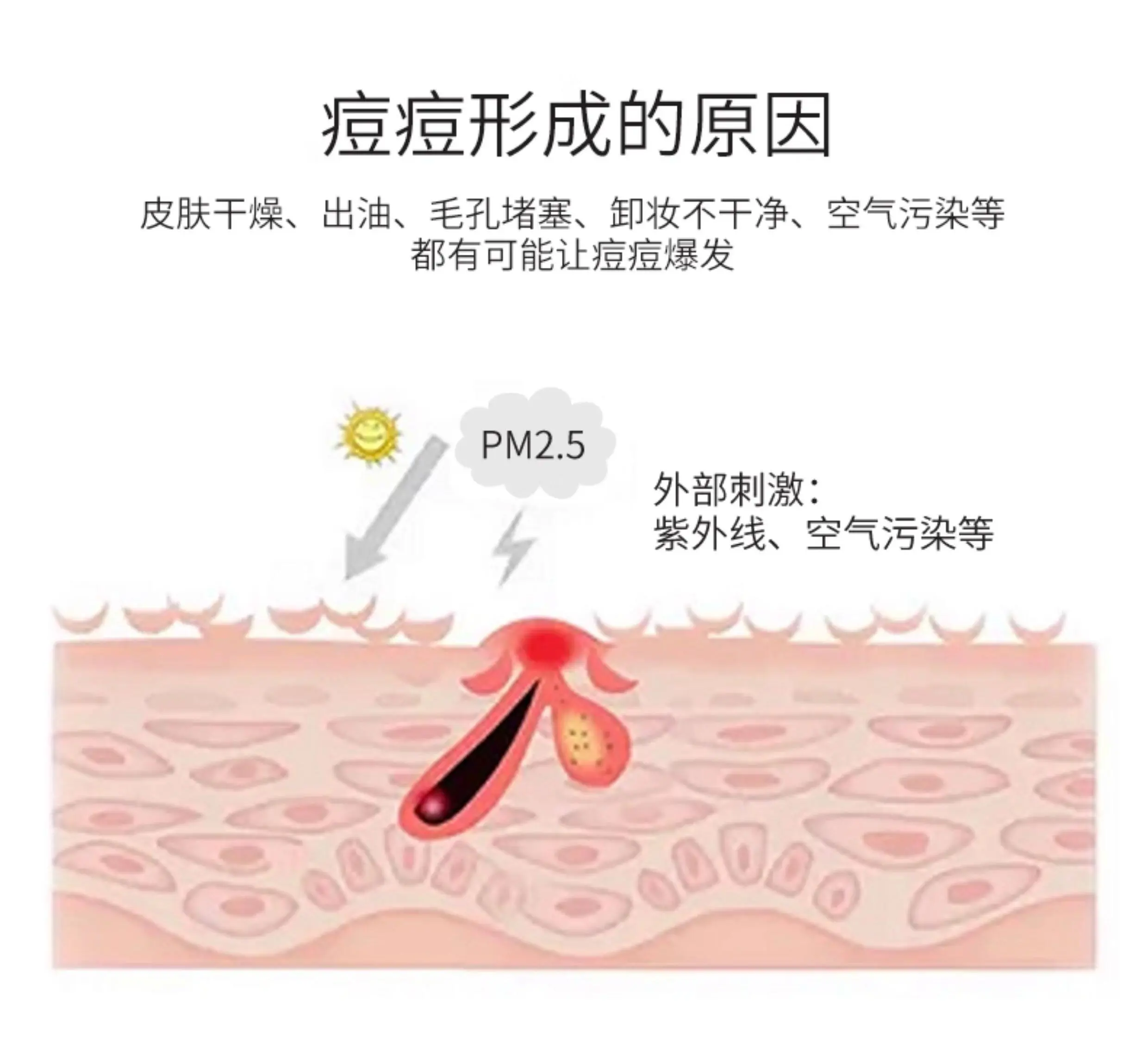 JunXian Acne Relief Cream