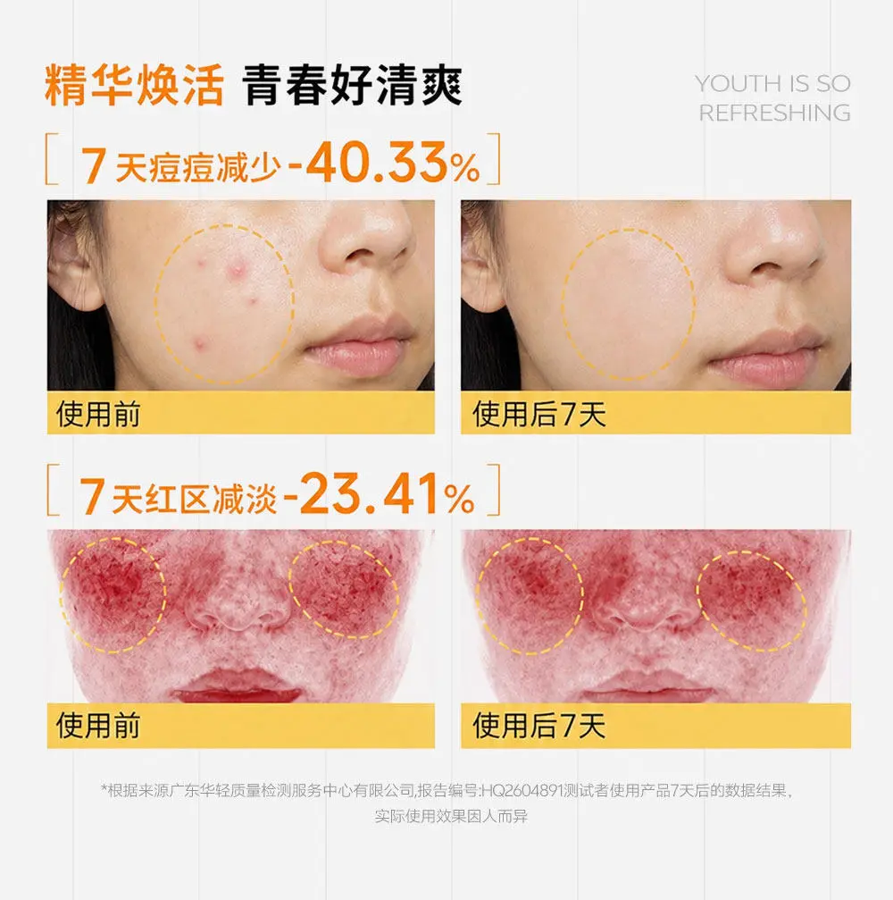 JunXian Colloidal Sulfur Acne Pen