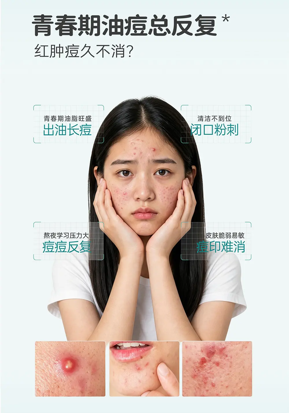 JunXian Huanglian Acne Cream