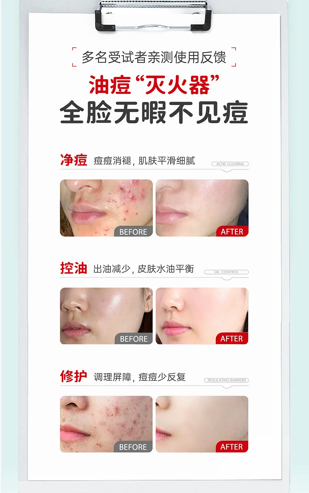 JunXian Huanglian Acne Cream
