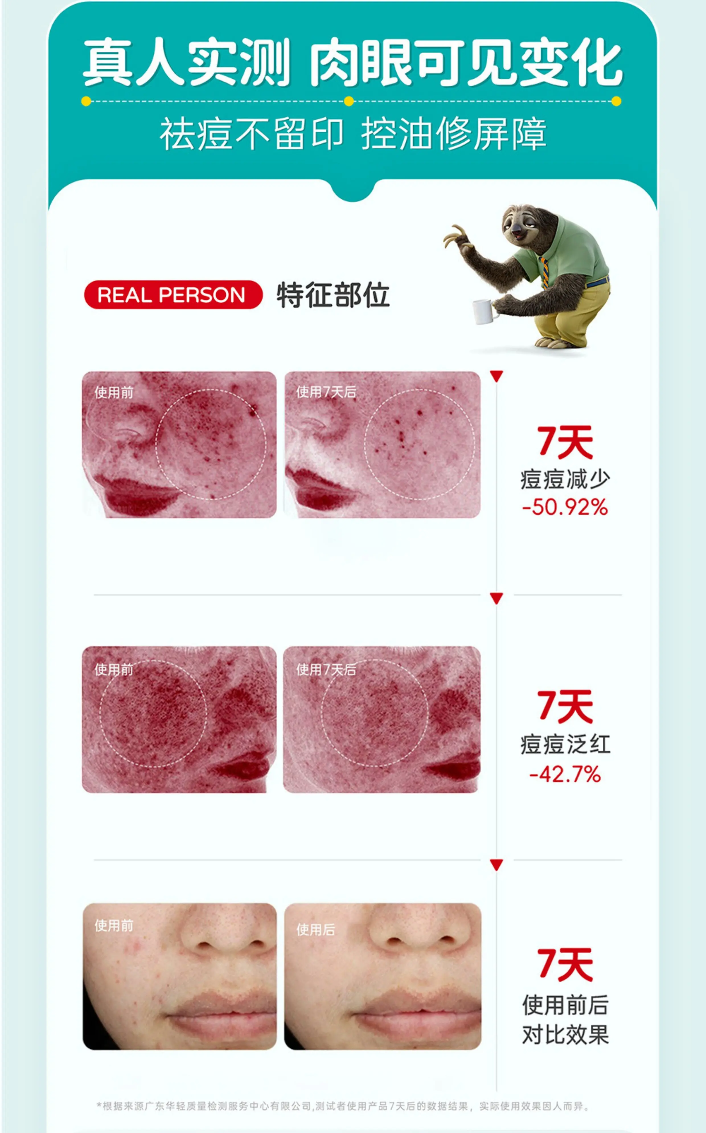JunXian Huanglian Acne Cream